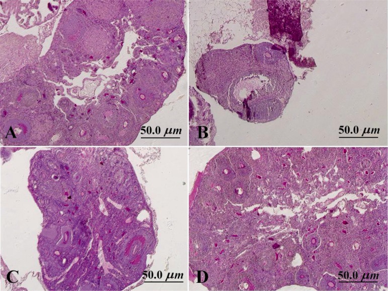 Figure 2 Photomicrographs of mouse ovary in different groups; A: control mouse; B: nicotine treated mouse; C: melatonin-treated mouse and D: nicotine + melatonin treated mouse. Notice regression of ovary and decrease in number and size of follicles i