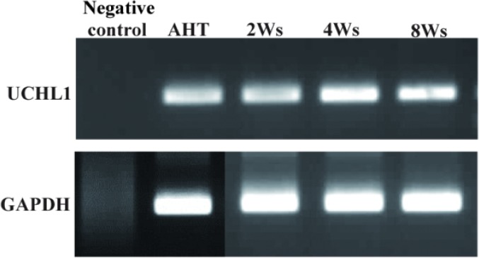 Figure 2 RT-PCR representation for spermatogonial stem cell marker UCHL1 in adult human testis (AHT) tissue and throughout the entire culture. GAPDH was used for cell presence