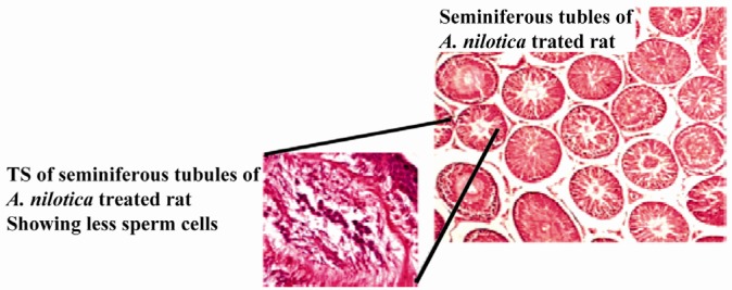 Figure 2 Transverse sections (TS) of the seminiferous tubules of rats treated with Acacia nilotica