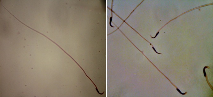 Figure 1 Morphology of rat spermatozoa (1000× magnification)