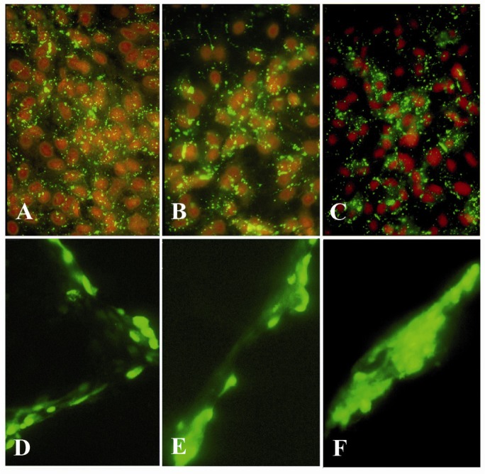 Figure 2 Immunolocalization of Cx43 (A-C) and lucifer yellow dye transfer (D-F) in GCs on day 4 of culture. GCs were plated on EHS-drip without androstenedione (A & D), with 10−7
M (B & E) or 10−5
M (C & F) androstenedione. Although Cx43 
