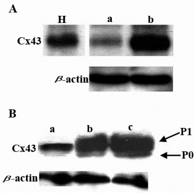 Figure 3 Effect of androstenedione on Cx43 expression. A. Western blot analysis of Cx43 protein in normal rat ovaries (lane a) and in androstenedione treated rats’ PCO ovaries (lane b). Lane H: heart sample Cx43 control. B. Western blot analysis of C