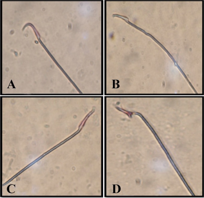 Figure 1 Representative photomicrographs of sperm. A: Normal sperm, B: sperm without hook, C: banana head sperm, D: sperm with triangular heads
