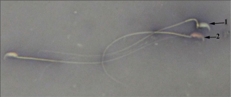 Figure 1 MTX+EP group, live sperm; 1: with uncoloured head and dead sperm; 2: with red head (Eosin Y Nigrosin ×1000)