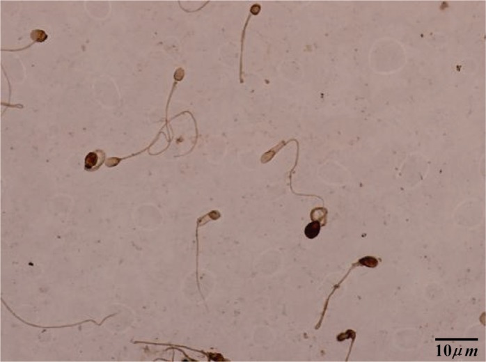 Figure 2 TUNEL staining: brown stained sperm shows apoptosis+, light colored sperm indicates apoptosis−