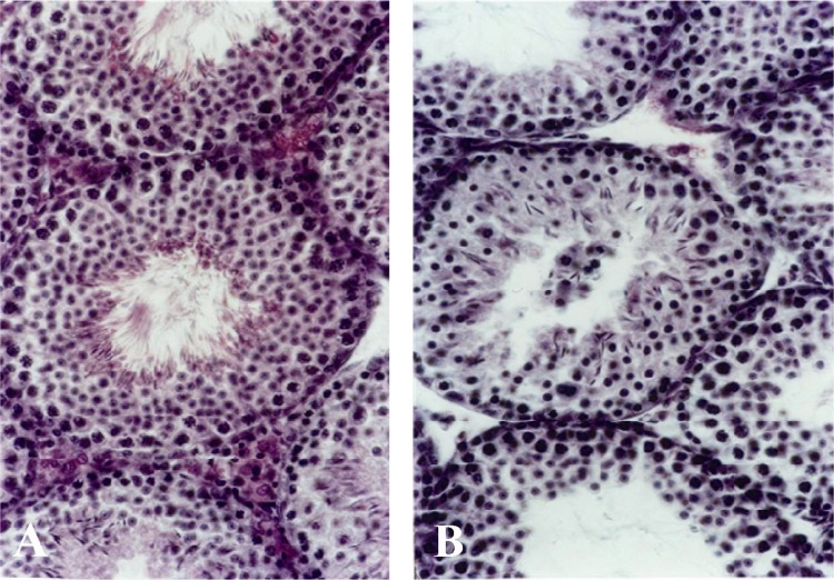 Figure 1 Histological micrograph of seminiferous tubule in A: control group, epithelial layers from adjacent of the basement membrane to centre of the tubule with presence of spermatozoa; B: group of 15 μM/kg, cells adjacent to the basement membrane