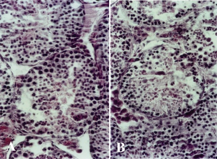 Figure 2 Histological micrograph of seminiferous tubule in A: group 25 and B: 30 μM/kg, disorganization of cell layers in the tubules and presence of more pycnotic cells. Magnification 400