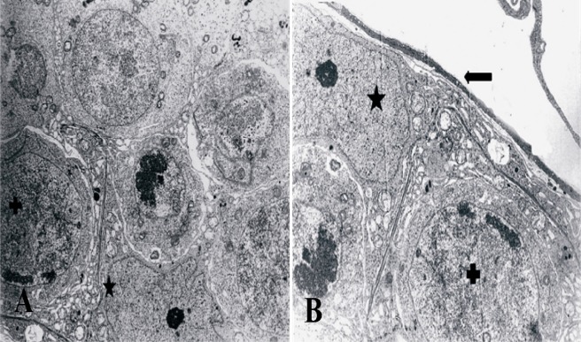 Figure 4 Ultrastructural micrograph of seminiferous tubule in group of 15 μM/kg: myoepithelial (Arrow), nucleous of Sertoli cell (*) with vacuoles within the cytoplasm and spermatogonia (+). A: *3000 magnification; B: *4400 magnification