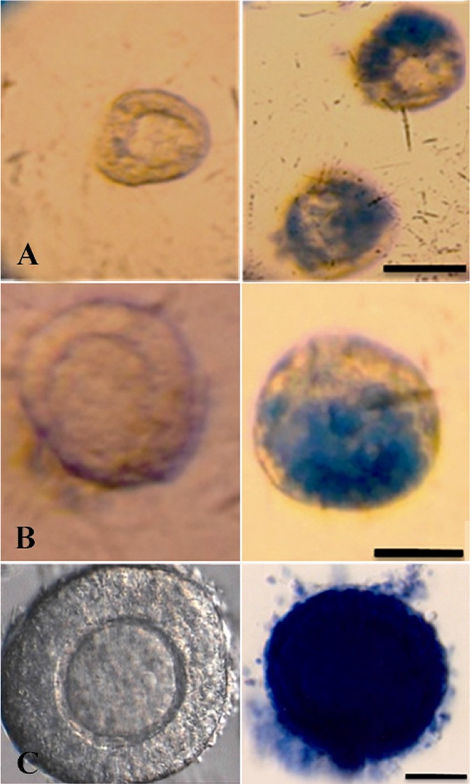 Figure 1. Trypan Blue staining for viability of follicles from vitrified ovarian tissues in different stages. A: Primordial follicles. B: Primary follicle; C: Secondary follicle. Scale bar=30 μm. In non-viable follicles, oocyte or the surrounding gra