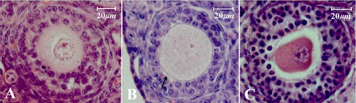Figure 2. Morphology of the secondary follicles after direct cover vitrification; A: normal or intact follicle; B: influenced follicle whit slightly disruption of contact between innermost granulosa cells and oocyte (black arrow); C: degenerated foll