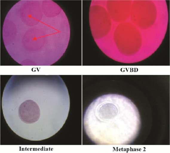 Figure 2. Oocyte staining and determination of the stage of nuclear maturation