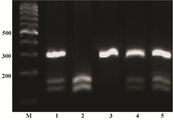Figure 1. PCR-based restriction analysis of the +49 A/G polymorphism was shown on 2% agarose electrophoresis. The polymorphic region was amplified by PCR resulting in a 289 bp fragment (AA wild type homozygote) in line 3 after size marker. Digestible