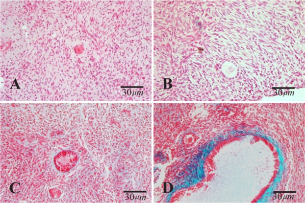 Figure 2. Light microscopic images of human ovarian cortical tissue after hematoxylin and eosin (A and B) and Masson Trichrome (C and D) staining after in vitro culture. A and C: non-vitrified group; Band D: vitrified group. The primary follicle has