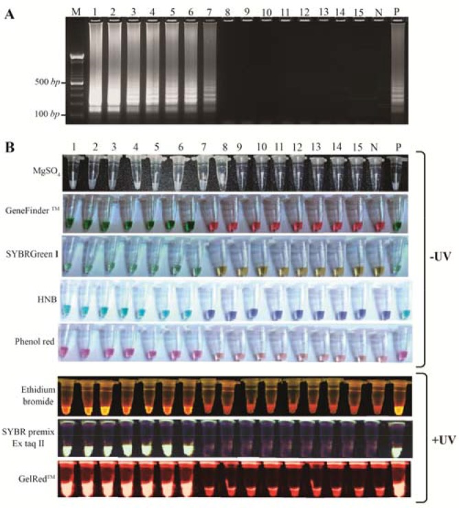 Figure 2. A: Gel electrophoresis pattern of LAMP amplicons on 1.5% agarose gel; B: Details of eight different visualization methods to analyze LAMP products. Lane M: DNA size marker (100 bp), lanes and tubes 1–7: positive samples, lanes and tubes 8–1
