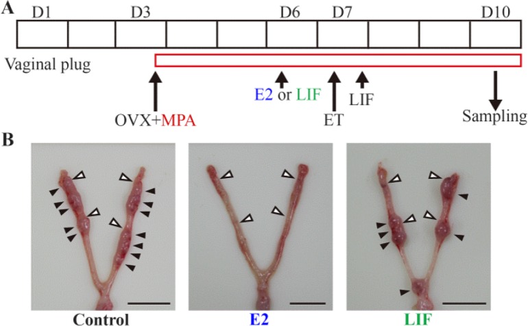 Figure 2. Embryo transfer to delayed implantation mice. (A) Experimental procedure for embryo transfer (B) the uteri treated with vehicle, leukemia inhibitory factor (LIF), or estrogen (E2). The solid black arrowheads point to implantation sites, and