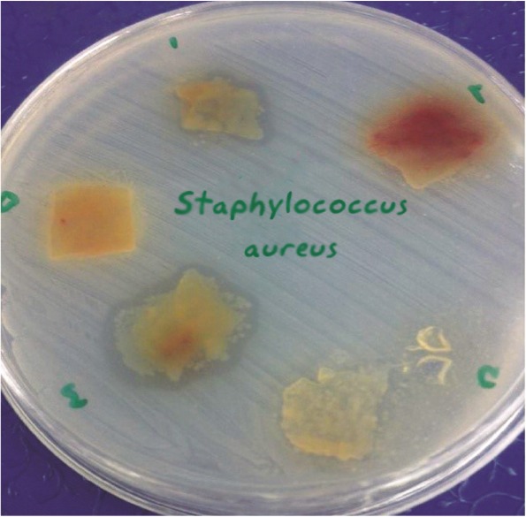 Figure 3. Formation of inhibitory zone of Staphylococcus aureus (ATCC29213) around amniotic tissue