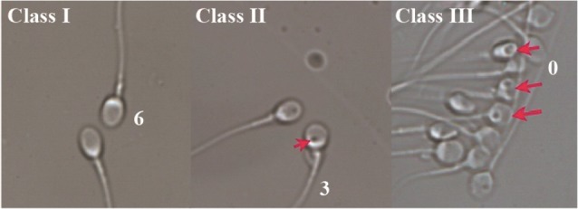 Figure 1. Spermatozoa at high magnification ×6000 with the aid of MSOME. A. sperm with class 1 without vacuole. B. sperm with class 2 with small vacuole. C. sperm with class 3 with large or multiple vacuoles