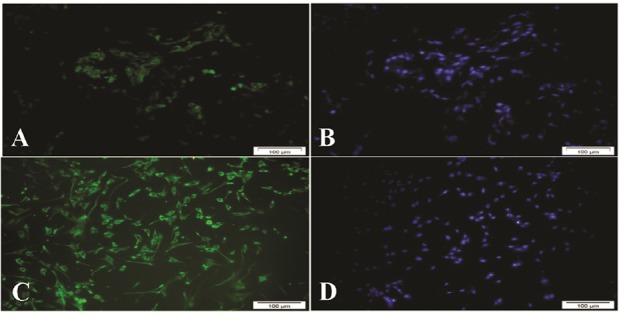 Figure 2. A, B: FSH receptor in human testicular tissue as a positive control: C, D: FSH receptor in cultured sertoli cells