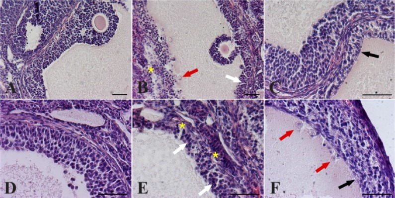 Figure 1. Effect of different hormonal treatment on the percentage of follicles presenting atretic/cystic signs. Descriptive images of peculiar morphological changes in antral follicle walls of ovaries isolated from controls (A, D) compared to DHEA-t