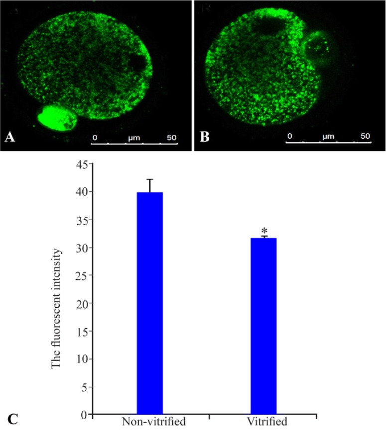 Figure 2. Distribution of mitochondria in non-vitrified (A) and vitrified (B) MII oocytes that were stained by Mitotracker green. The mitochondria are shown as green clusters within the ooplasm. The fluorescence intensity of MII oocytes in two groups