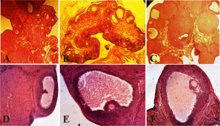 Figure 1. Histological analysis of normal ovaries (A, D) compared with PCOS (B, E) and ovaries treated with curcumin (C, F). The morphological changes of the rats’ ovarian tissues were stained with hematoxylin and eosin, as described in the Materials