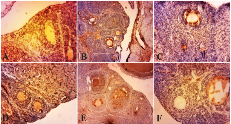 Figure 2. Photo micrographs of immunohistochemical expression of TNF-α in the primary and secondary follicles. (A) normal ovary; (B) strict expression of TNF-α is observable in these follicles in PCOS group; (C, D, E, F) TNF-α expression is restricte