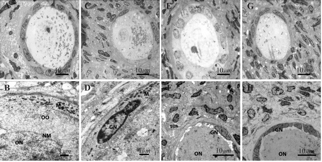 Figure 2. Ultrastructure of human ovarian follicles after 14 days of in vitro culture in the presence and absence of LIF. (A) Nonvitrified–LIF+ group; (B) Vitrified–LIF+; (C) Non-vitrified–LIF−; (D) Ditrified–LIF−; (E–H) High magnification images of 