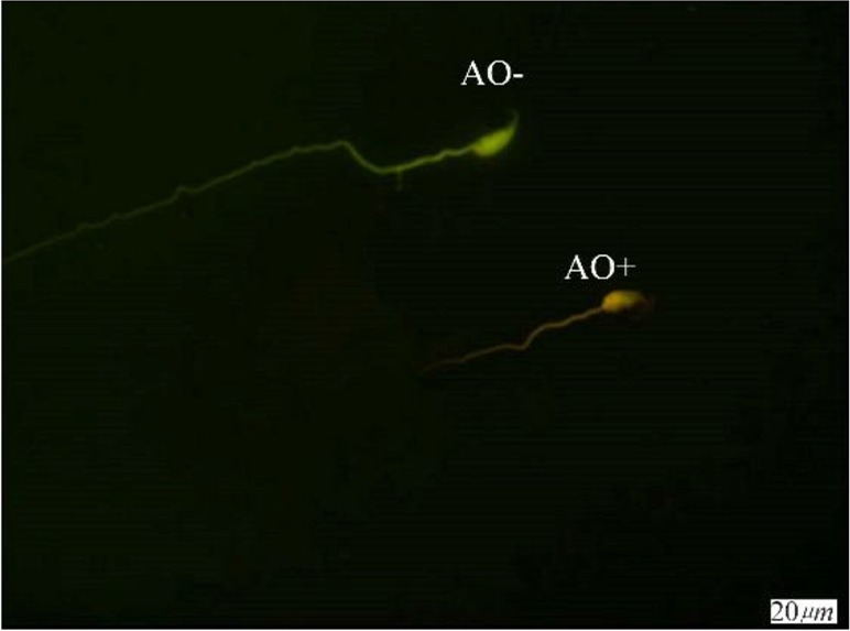 Figure 3. Spermatozoa with native double-stranded DNA (AO−) and denatured DNA (AO+); Acridine Orange staining (×100 eyepiece magnification)