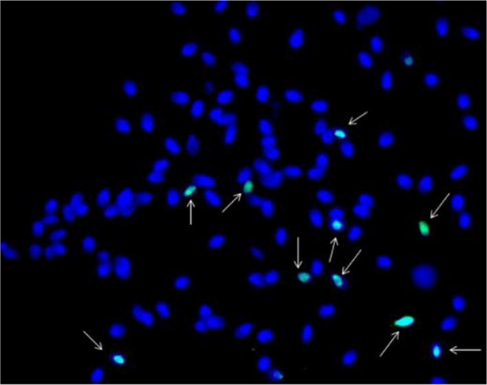 Figure 3. TUNEL Assay picture. Sperms with DNA damaged (green) were shown with arrows and Sperms without DNA damage were in blue color