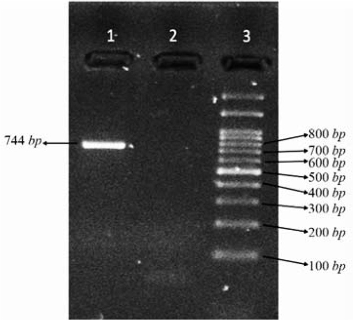 Figure 1. Electrophoresis of the PCR product of exon 10 (Lane 1: PCR product, Lane 2: no template control (NTC), Lane 3: 100 bp DNA ladder)