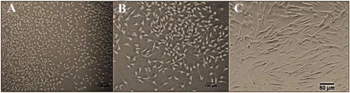 Figure 1. Human amniotic mesenchymal stem cells in the culture. The cells at the third passage, almost all of the cells were elongated and spindle-shaped. A) Magnification 100×. B) Magnification 200×. C) Magnification, 400×