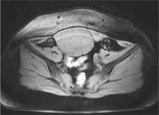 Figure 1. MRI view