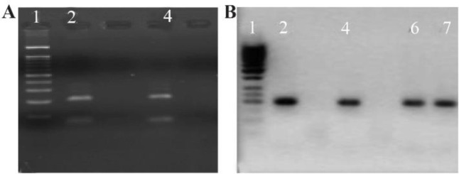 Figure 1. Detection of HPV genotype by PCR in semen cases. Gel figure A shows the presence of HPV 18 infection with an amplicon of E6 consensus (208 bp) and gel figure B represents the amplicon of HPV 16 E7 (196 bp). A: Results of PCR HPV 18 genotype