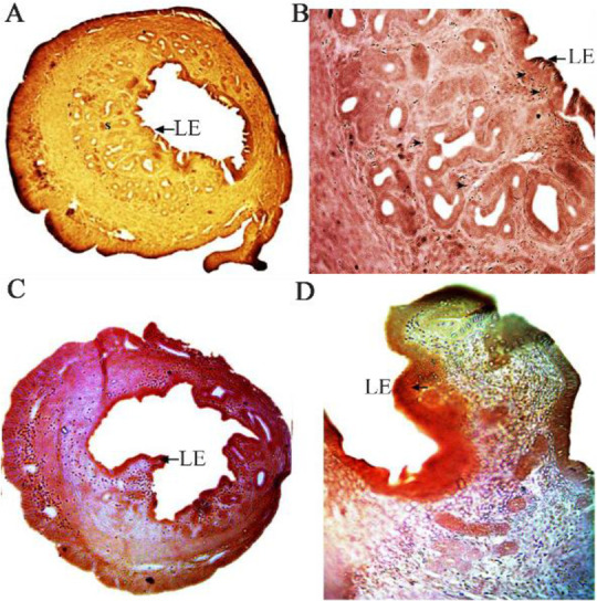 Figure 1. Immunohistochemistry of PCNA in cyclic control (A & B) and cyclic extract treated (C & D) mice. PCNA expression (arrow head) is found in the endometrial stromal cells (S) and luminal epithelium (LE). Original magnification: A & 
