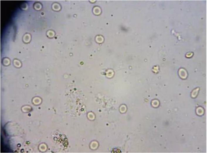 Figure 6. One spermatozoon was found onsite