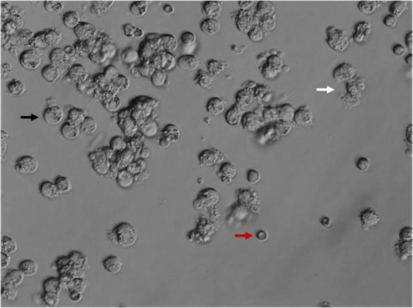 Figure 2. Cumulus cells obtained after decumulation. Note the difference of cumulus cells (Black arrow) from lysed cumulus cells (White arrow) and erythrocytes (Red arrow) prior to sample tubing for genetic analysis
