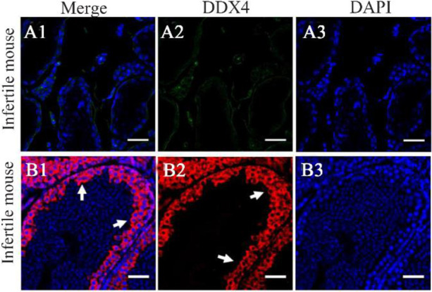 Figure 2. Immunohistochemical analysis of sterile and fertile mice. Non-detectable expression of DDX4 in busulfan-treated mice (Merge, A1). Expression of DDX4 in the germinal epithelium of fertile mice (Merge, A1)