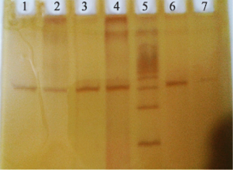 Figure 2. PCR PAGE GEL. Lane: 1, 2, 3, 4, 6-Amplified PCR products of exon-2, MED-12. Lane: 5-100 base pair DNA ladder. Lane 7-Negative control