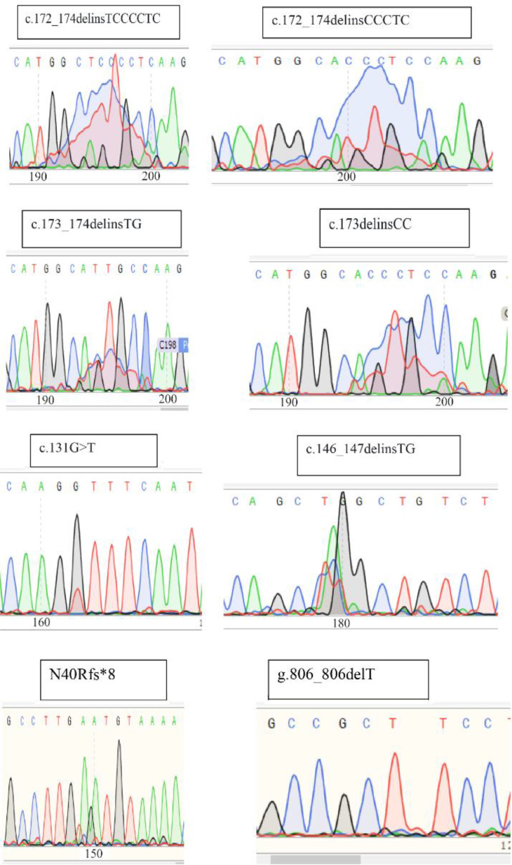 Figure 3. Sequence chromatogram of somatic mutations in MED-12 in and around codon 58