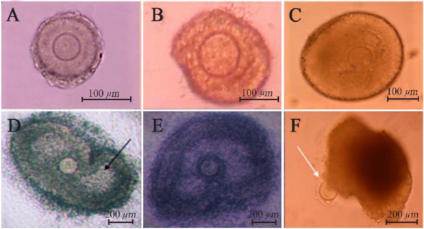 Figure 1. Images of mouse PFs during in vitro culture; PFs on the first day (A), 4th day (B), 6th day (C), 8th day (D), and 10th day (E) ovulated oocyte; white arrow (F) antrum cavity; black arrow