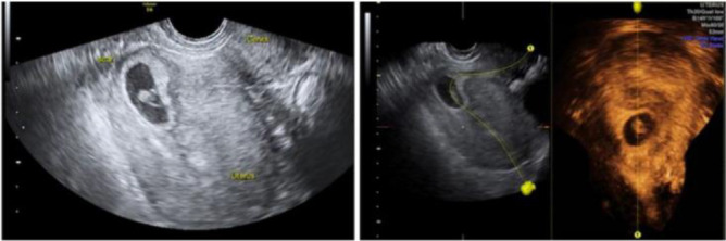 Figure 5. 2D and 3D USG view of the CSEP
