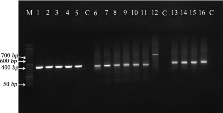 Figure 4. Agarose gel electrophoresis for mtDNA PCR products. Samples 1–5 for mtDNA confirmation using (F1–R1) mtDNA primers (Bands sizes of 414 bp). Samples 6–11: bands of 406 bp size for confirmation of 7599 bp deletion using (F4–R3) 7599 bp primer