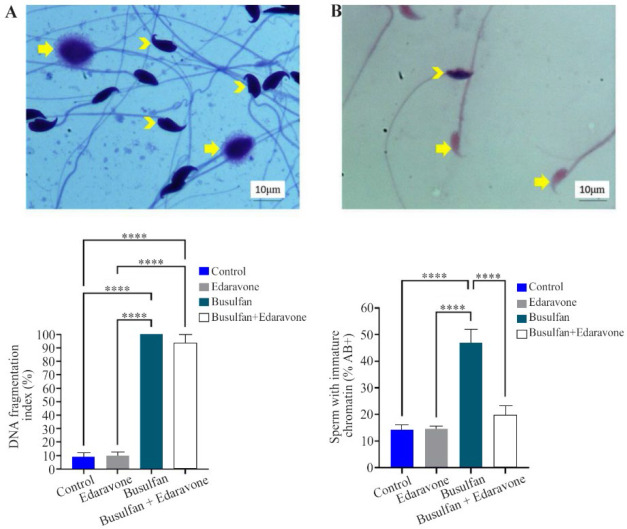 Figure 2. A) Photomicrograph of the DNA fragmentation index and sperm chromatin maturation, 100X. Sperm DNA fragmentation (arrowhead) and, healthy sperm (arrow), and B) Mature chromatin (arrow) and immature chromatin (arrowhead). Mean±SD of the perce