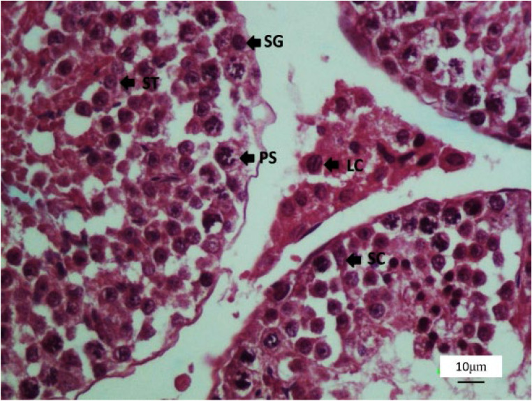 Figure 6. Photomicrograph of the testis stained with H&E, 40X. SG (spermatogonia), PS (primary spermatocyte), ST (round spermatid), SC (sertoli cell), and LC (leydig cell)