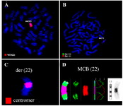 Figure 2. Karyotype and chromosomal aberrations were confirmed using molecular cytogenetic approaches. (A) A robertsonian translocation rob (22;22) was identified using the whole chromosome painting probe (B). Application of the probe Di-George probe revealed two red and two green signals on the derivative chromosome 22. (C) Application of all human centromer probe confirmed rob (22; 22). (D) The application of aMCB (22) confirmed rob (22;22)(q10;q10). Abbreviations: der = derivative chromosome