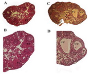 Figure 1. Morphological comparison of control and DHEA-treated PCOS mice ovaries. Control/vehicle ovary showed several follicles in different developmental stages. Corpus luteum (CL) structure is also shown (A, B); DHEA-treated PCOS mouse ovary showed various stage developing follicles but a high number of antral and preantral follicles and some large follicular cysts (FC) and/or hemorrhagic follicular cysts (HFC). The morphology of cysts is described by a thin layer of theca cells and a compacted formation of granulosa cells. Corpus luteum was absent in polycystic ovary (C, D). Scale bar: 50 &micro;m