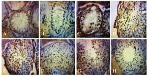 Figure 1. Microphotograph of immunohistochemical CDC25A staining in testis tissue (400X magnification). A: Johnsen scoring 2; B: Johnsen scoring 3; C: Johnsen scoring 4; D: Johnsen scoring 5; E: Johnsen scoring 6; F: Johnsen scoring 7; G: John-sen scoring 8; H: negative control