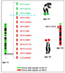 Figure 3. Physical map of the breakpoint regions of 11q23.2 and 13p region