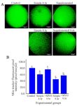 Figure 2. The effect of preincubation time and myo-inositol supplementation on the amount of mitochondria in mouse MII oocytes. A) MII oocytes preincubated in each simple and supplemented medium for 0, 4 and 8 hr were dyed with Mito Tracker Green to determine amount of mitochondria. Scale bar indicates 20 &mu;m. B) The fluorescent intensity of MII oocytes stained by Mito Tracker Green. Fluorescent intensities of each stained oocyte were quantified with Image J software (ANOVA, p&lt;0.001; Tukey&rsquo;s post hoc, p&lt;0.001)