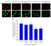 Figure 3. The effect of preincubation time and myo-inositol supplementation on the mitochondrial membrane potential in mouse MII oocytes. A) MII oocytes preincubated in each simple and supplemented medium for 0, 4 and 8 hr were dyed with JC-1 to detect mitochondrial membrane potential. Scale bar indicates 100 &mu;m. B) The fluorescent intensity of MII oocytes stained by JC-1. Red/green fluorescent intensities of each stained oocyte were quantified with Image J software (ANOVA, p&lt;0.001; Tukey&rsquo;s post hoc, p&lt;0.001)